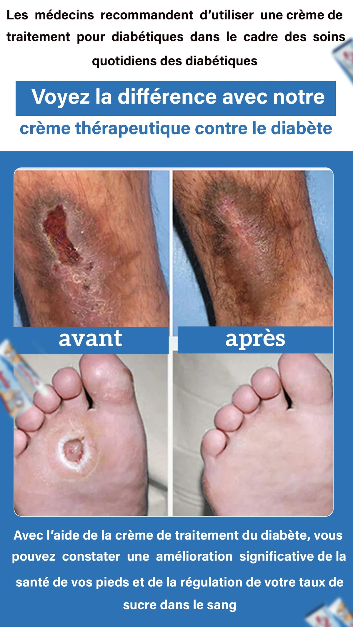 Crème diabètique professionnelle